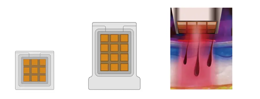 alexmed pro touch+ipl