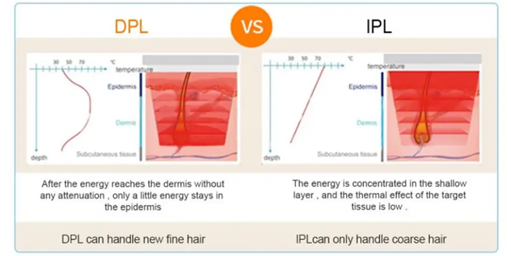 alexmed pro touch+ipl