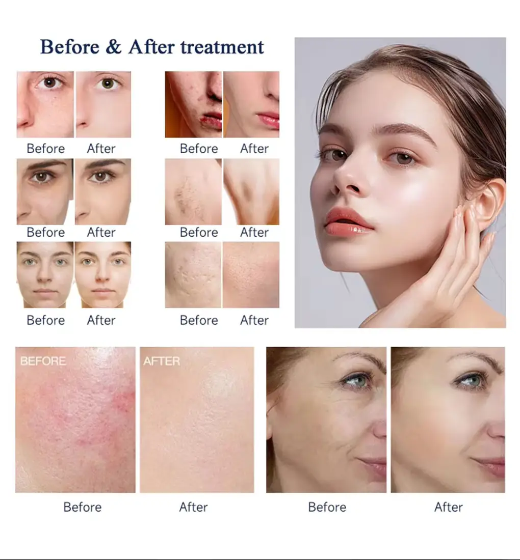 depimedix android s dpl+dpl