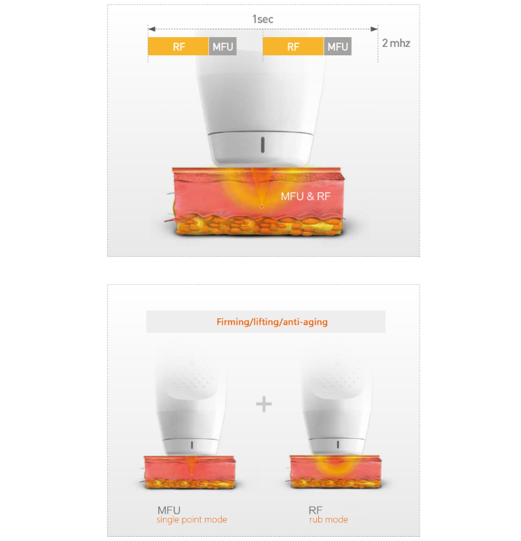 portable 4 in 1 ice smas hifu cold hammer body slimming vmax antiaging micro needle face lifting morpheus 8 fractional machine