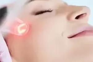 rf microneedling vs. co2 laser resurfacing banner